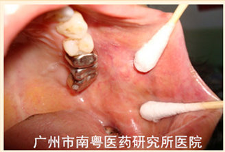 60岁_副本11.jpg