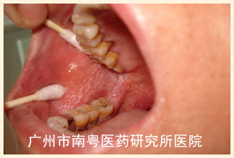 患者女，56岁.jpg