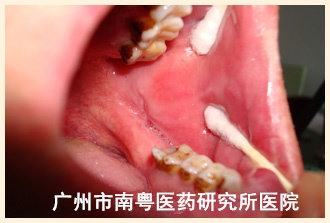 王某副本.jpg