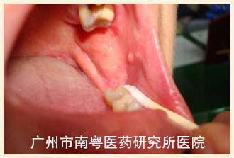 钟某副本.jpg