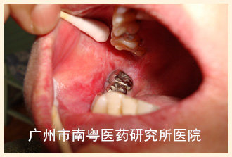 张某.jpg