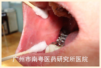 张某副本.jpg